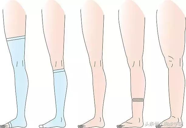 腿肿正确站姿,腿粗是因为胖还是以为腿型不好