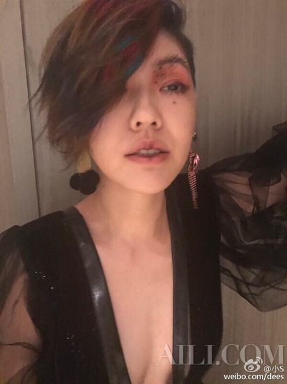 明星脸上的痣是怎么去掉的,明星都是怎么去掉脸上的痣