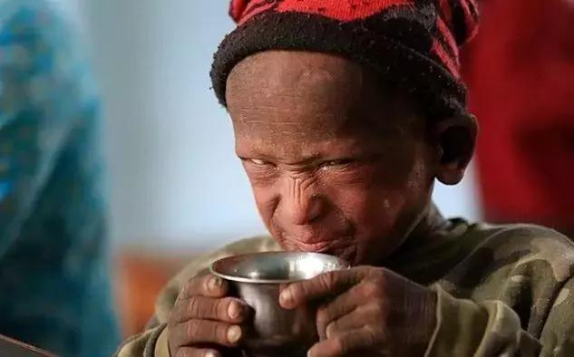 印度男孩身上长满了什么,印度11岁男孩长满鳞片