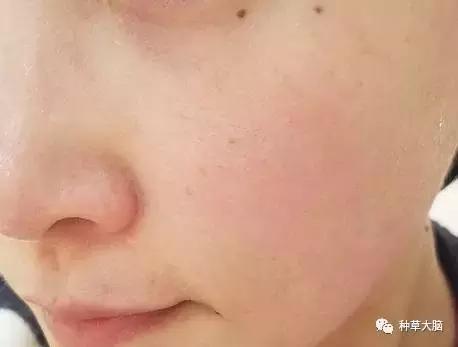 黑头白头能有效去除吗,一涂黑头就冒出来的面膜