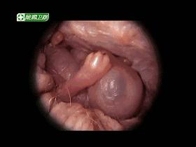 子宫日记解密生命孕育全过程,子宫日记央视纪录片