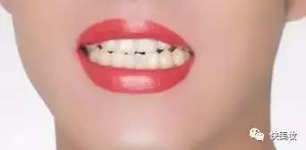 总被说牙齿黄,牙齿很黄是不是很讨人厌