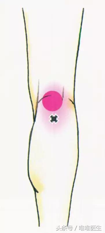 膝关节科普文章,膝关节疼痛最全解析