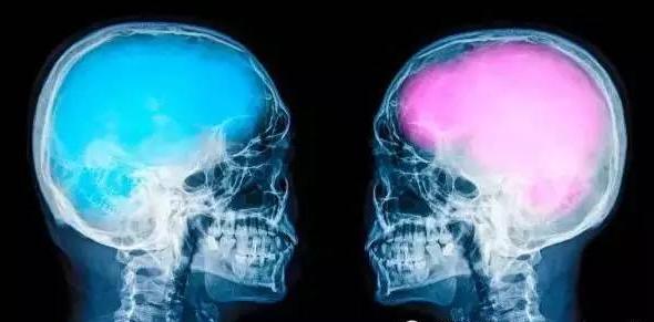 人类大脑都一样吗,人类大脑与人工智能