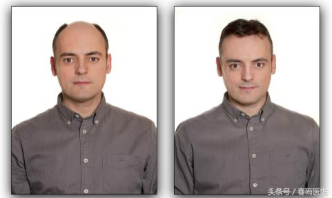 同样年龄看起来有些人显得年轻,同样年龄为什么有人看起来更年轻