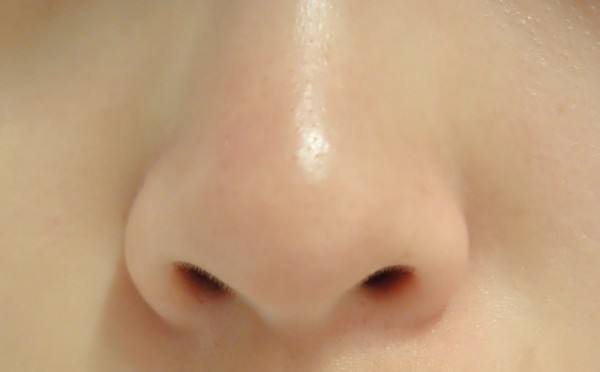 说一说祛黑头这事儿