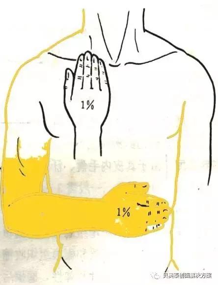 烧伤深度与临床表现图,氢氟酸烧伤的临床表现