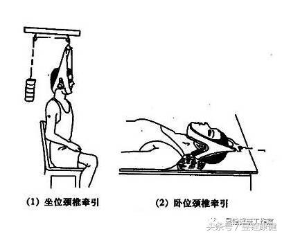 治疗颈椎病专业书籍,颈椎病的治疗的书籍