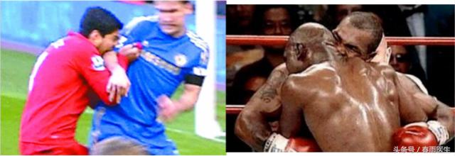 被人咬了能让对方赔偿吗,被人咬了要赔钱吗