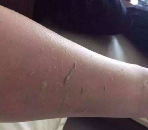 润大通林：洗澡搓出来的“泥”是什么？