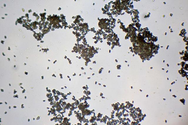 详解霉菌的危害和应对方案