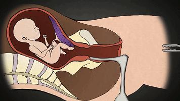 LAN《性、安全、录像带》