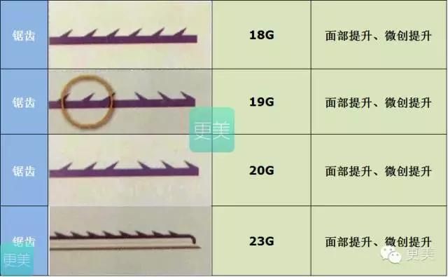 埋线美容线和不吸收线有什么区别,医院埋线和美容院埋线有什么差别