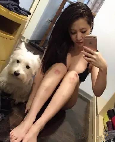 祛疤妙招—日本处方祛疤膏