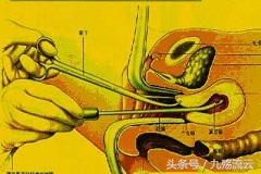 女性怀孕多久可以做人流,意外怀孕哪个时间段做人流最合适