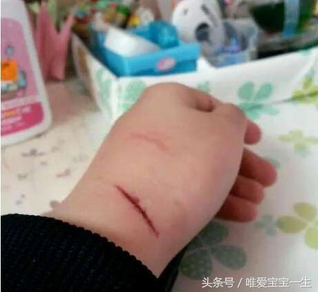 宝宝缺锌怎么办看完这些十分受益,如何自测周岁宝宝缺锌缺铁