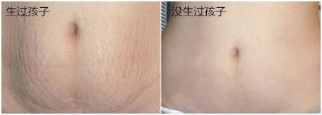 4招教你看出女人生过孩子,判断女人生过孩子最简单方法