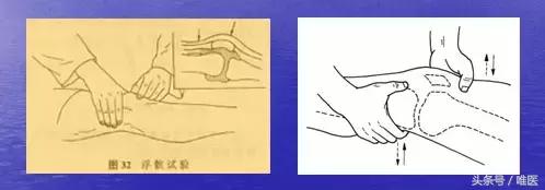 前交叉韧带损伤康复训练,交叉韧带半月板损伤康复训练视频
