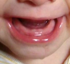 宝宝长牙妈妈牙也会不舒服吗,宝宝长牙妈妈牙齿痛