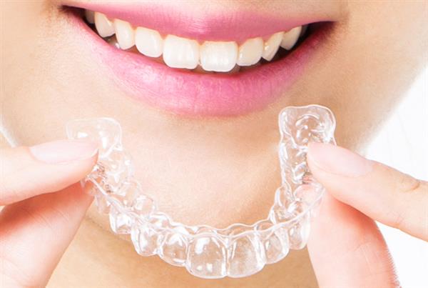 再也不做钢牙妹｜3D打印隐形牙套—上海正雅齿科获5000万B轮投资