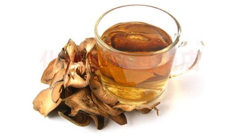 风热咳嗽临床表现,风寒风热咳嗽区别