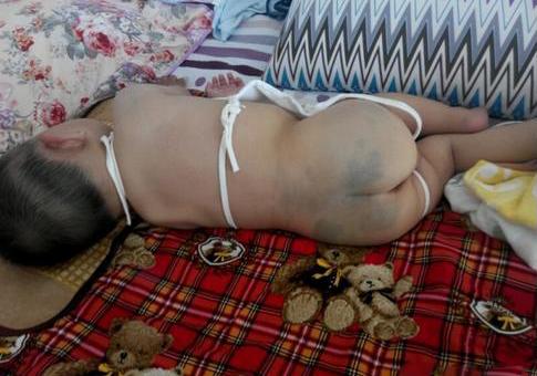 新生儿身上好多青色胎记怎么回事,新生儿很多胎记怎么回事