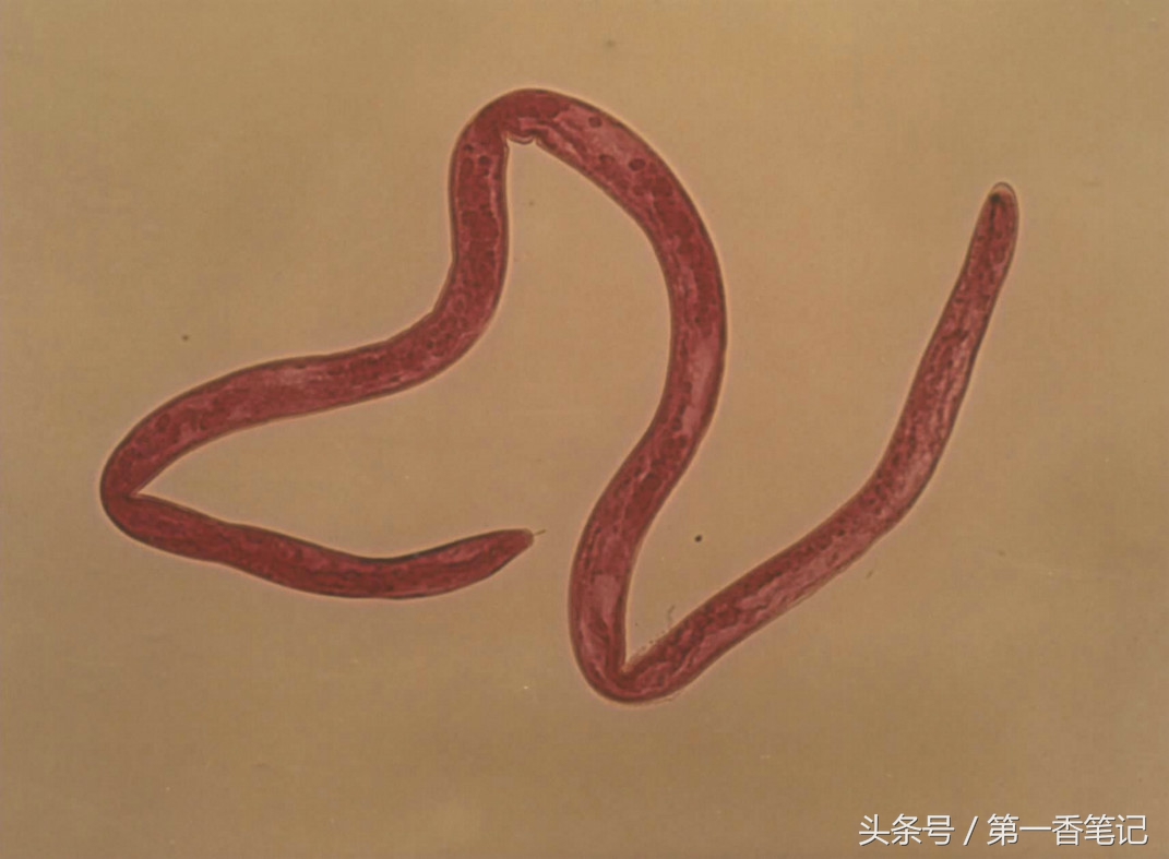 兰叶长介壳虫怎么处理,养兰宜忌