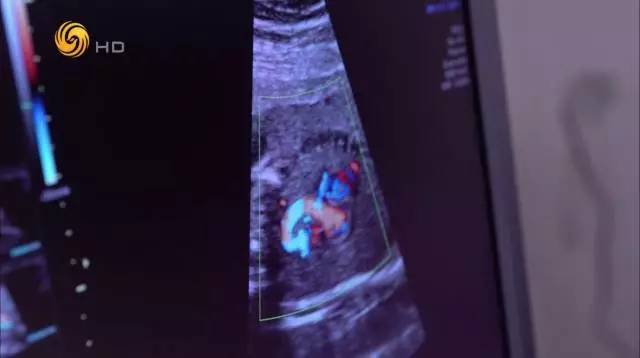 产妇难忍阵痛求剖腹,产妇腹疼难忍