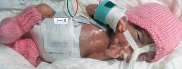 这些被誉为“世界之最”的宝宝，你听说过几个？