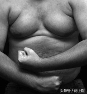 药物极罕见的副作用需要担心吗,7种奇怪药物副作用