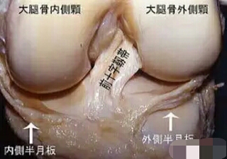 膝关节韧带受伤该怎么办？如何检查膝关节韧带受损？