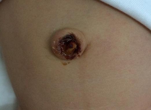 新手妈妈导致婴儿死亡事件,新手妈妈带娃出现的意外