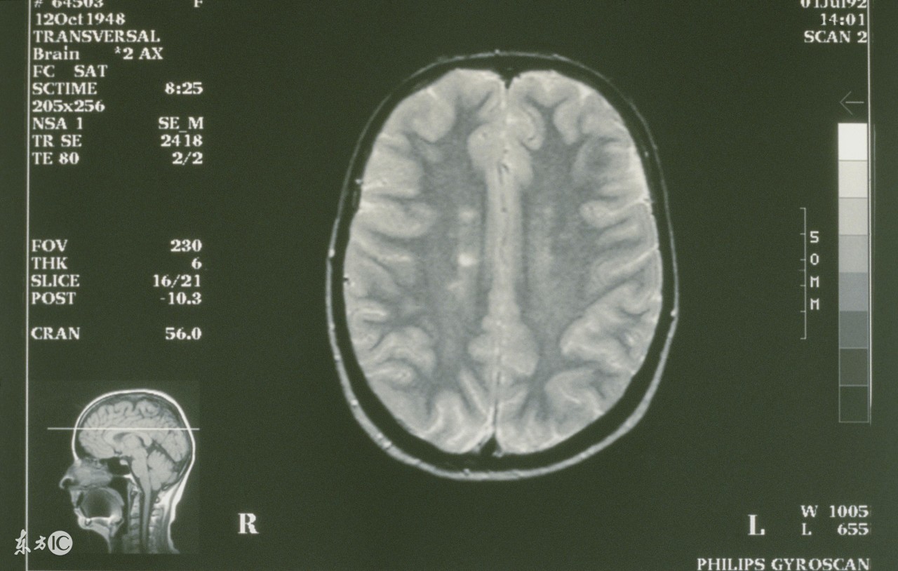 年轻人手抖的10大疾病征兆是什么,老年人手抖腿抖是什么病的征兆