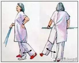 髋关节置换后护理康复训练视频,髋关节置换术后康复护理app