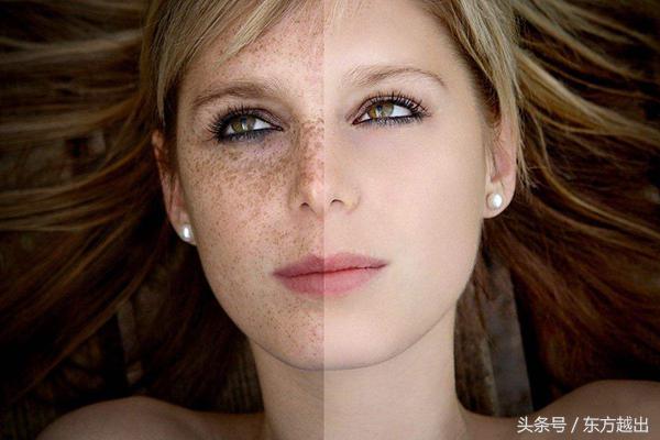 祛斑最好的方法目前最有效的,手上老年斑祛斑最有效方法