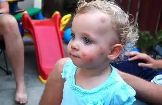 木瓜膏为什么这么神奇,澳洲木瓜膏都有哪些明星在用