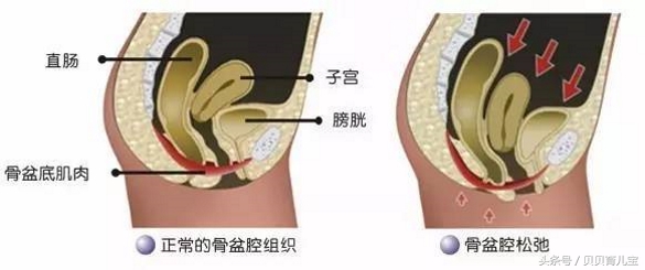 产后修复不重视,身体差的产后妈妈会出现什么症状