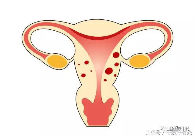 月经量少怕影响怀孕要做哪些检查,月经量少只来两天对怀孕有影响吗