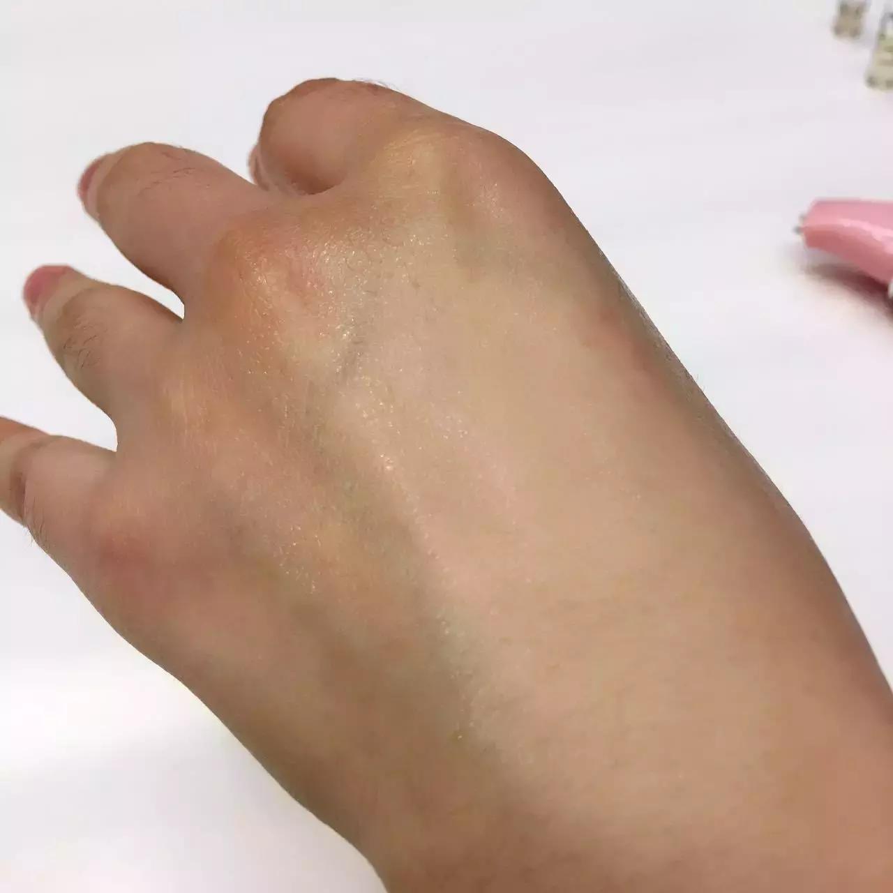 劲爆｜全球最牛X的5款玻尿酸大测评