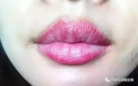 重度乌唇怎么改善能变红唇,乌唇应该用什么颜色做唇好看