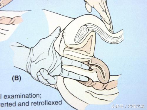 生孩子是十指开全了才用力吗,生小孩的开十指是掰开的吗