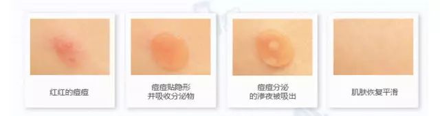 屈臣氏值得买的平价好物,屈臣氏里这10款产品好用到哭