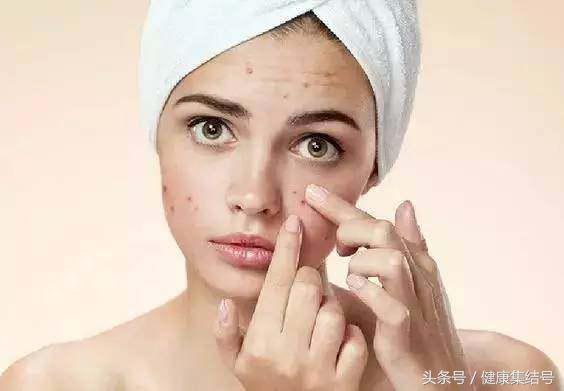 色斑的预防和治疗快速去除色斑,色斑的原因及治疗方法