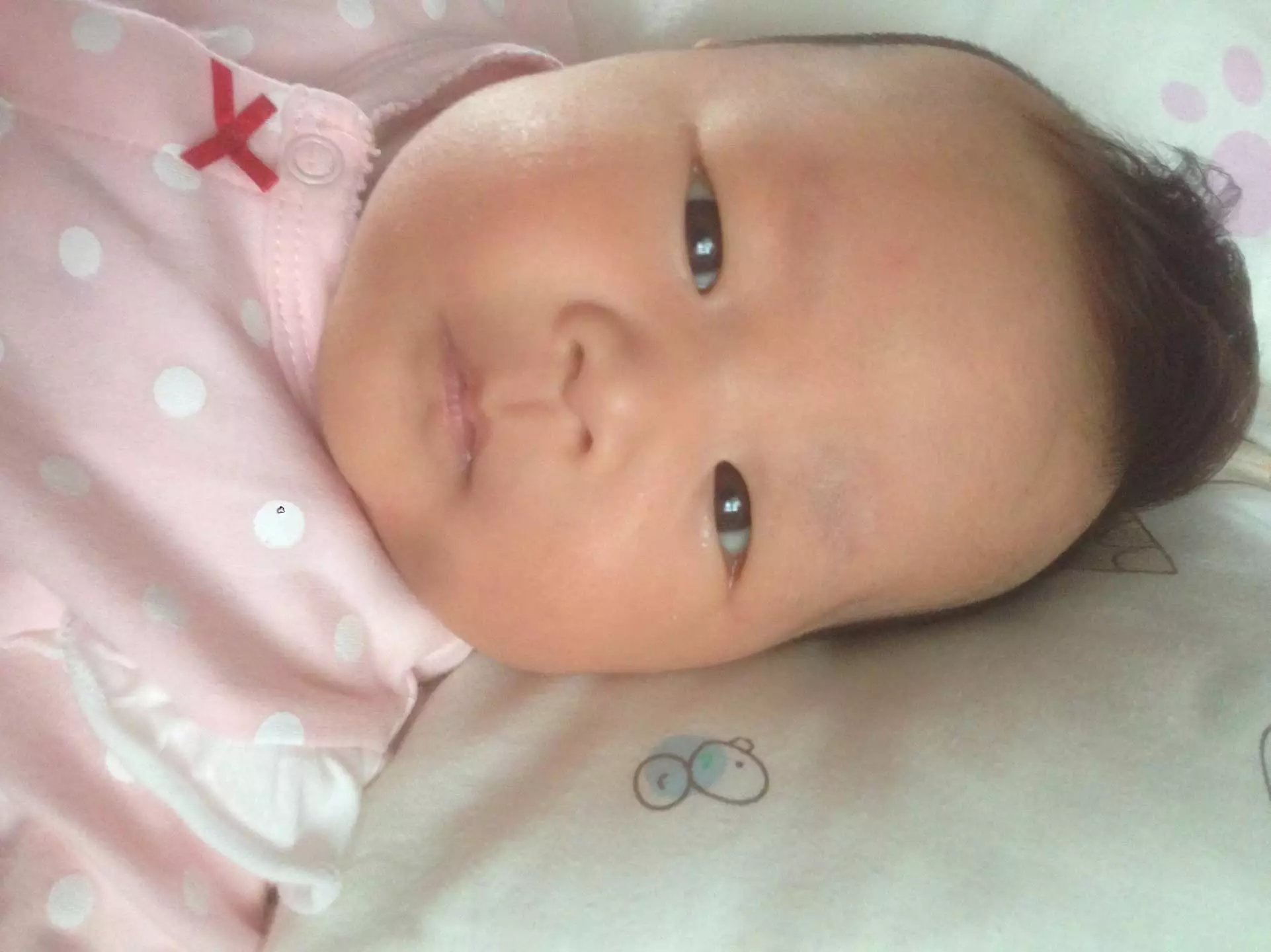 如何预防宝宝夏天长痱子,秋季痱子怎么快速消除