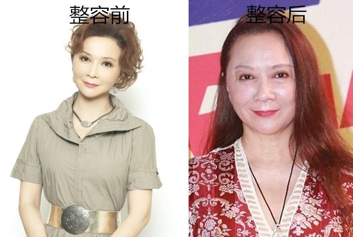 俄罗斯专家注射细菌抗衰老,抗衰老的细菌