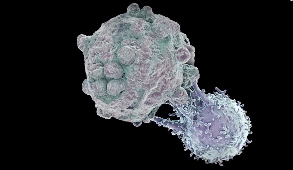 2017年国际癌症科学取得三项突破