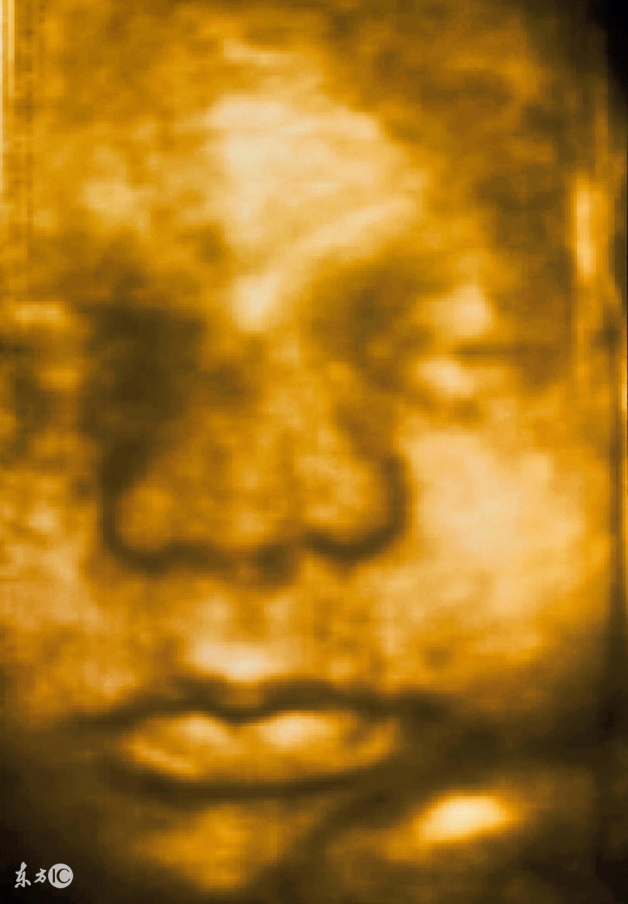 预约三维彩超,二胎时代超声波检查