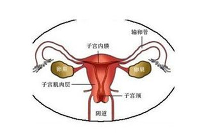 中药治疗慢性宫颈炎,慢性宫颈炎会变成宫颈癌吗