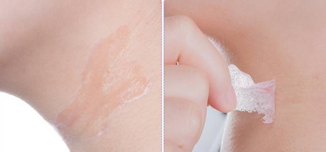 一条颈纹老十岁教你一招淡化,年纪小就有一条很深的颈纹