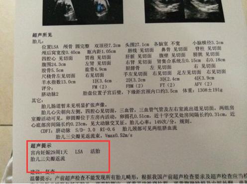 孕期宝宝胎位都有哪些检查,孕妇胎位检查